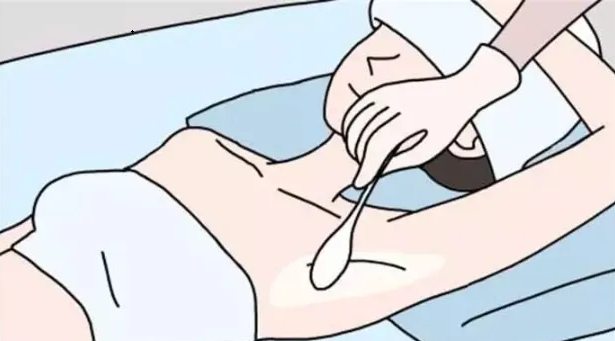 腋臭3